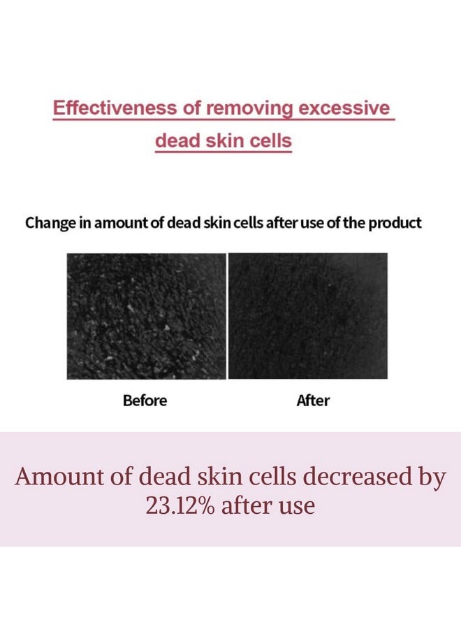 M] Fig Boosting Essence 150Ml - Lightweight Hydration With Bha, Nmf Peptide, And Polyphenol For Smooth Skin Prep, Full Hydration, And Anti-Aging Effects