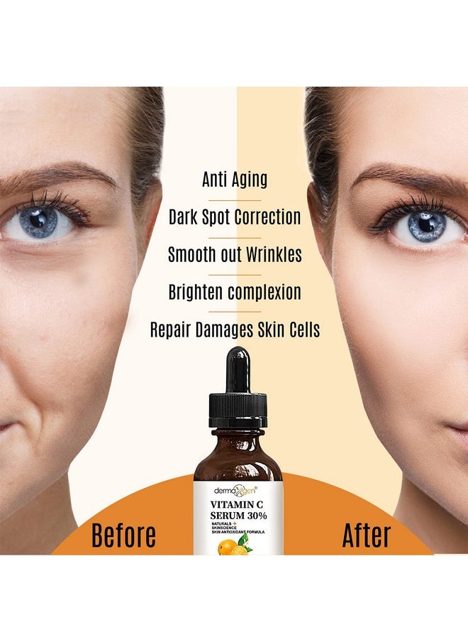 30% Vitamin C Serum For Face, Hyaluronic Acid + Vitamin (B3 + E) + Jojoba + Aloe Vera- Natural & Organic Anti Wrinkle & Skin Rejuvenator Moisturizer Vitamin C For All Skin - Anti Aging Serum (4 Fl Oz)