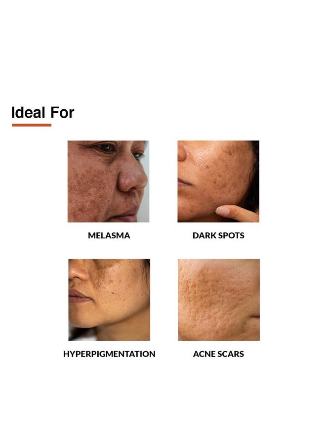 3% Tranexamic Acid + 2% Kojic Acid + 1% Arbutin Skarfix -Tx Face Cream 15Gm (Pack Of 1)