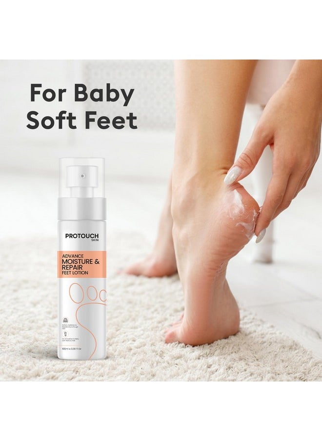 Advanced Moisture & Repair Feet Lotion | For Dry & Cracked Feet | Hydrating & Soothing | Lightweight Formula With Shea Butter & Lactic Acid | 100Ml (Pack Of 1)