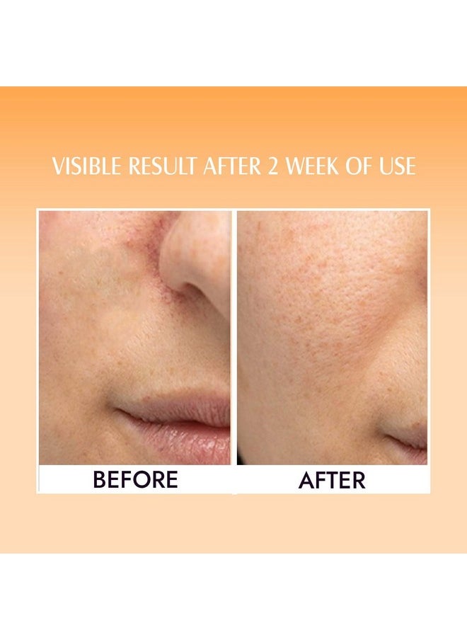 20% Vitamin C Face Serum For Brightening, Dark Spots, Dull Skin,Uneven Skin Tone - For All Skin Types - 30 Ml