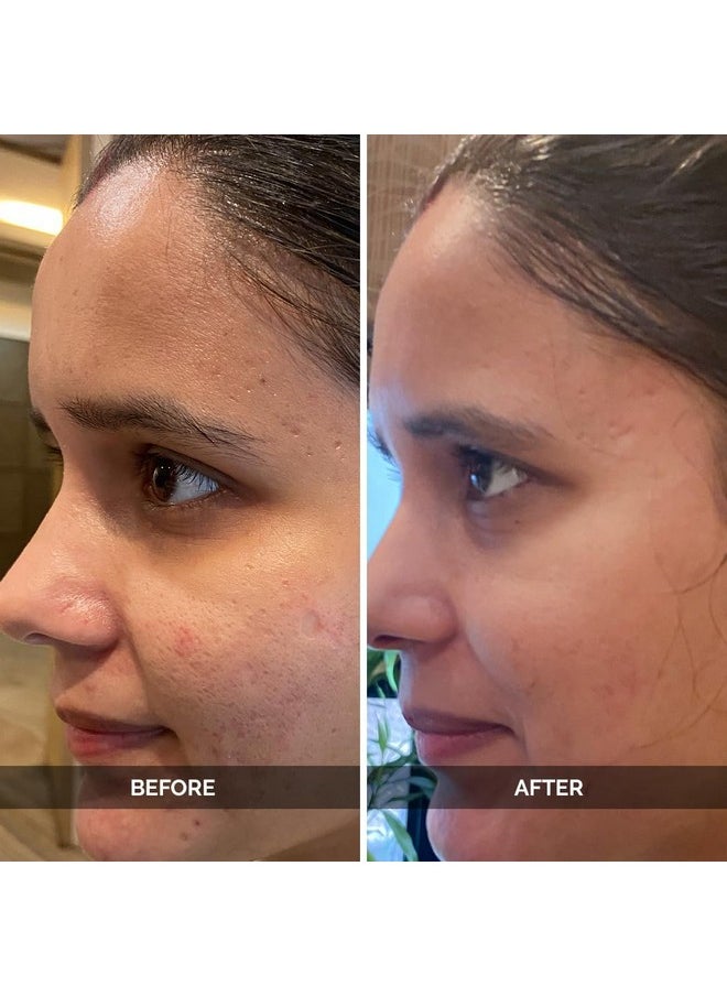 Pore Perfecting Face Serum - Minimizes Pores, Controls Oil & Sebum, Firms Skin | 96% Natural Ingredients With Lotus Water, Alpaflor® Alp-Sebum, Syn®-Coll, Galactomyces | Korean Skincare - 30Ml