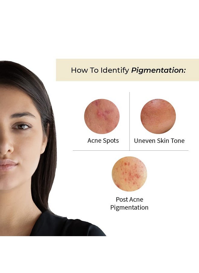 Face Serum, Customised Ayurvedic Avas Spot Correcting Face Serum For Dark Spots & Pigmentation With Vitamin A + Vitamin C + Onion + Lodhra + Bakuchi - 20 Ml