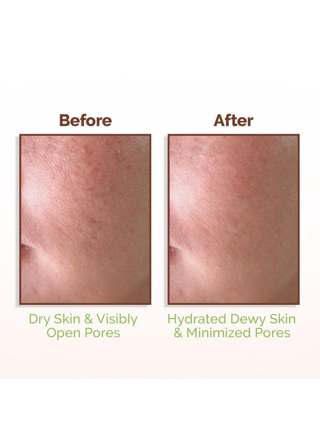 Rice Water Dewy Face Toner With Rice Water & 4% Niacinamide For Glass Skin 150Ml |Intensely Hydrates |Minimizes Pores |Even Skin Tone |Korean Rice Toner | Alcohol-Free| Suits All Skin Types