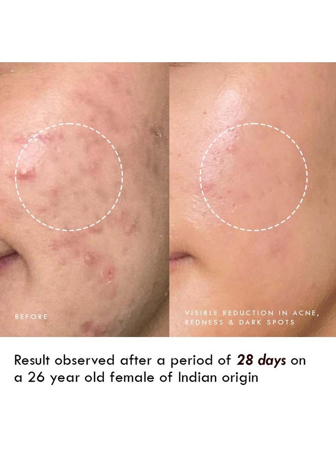 Auli 24K Gold And 5% Niacinamide Hydrating Gel For All Skin Types | Hydrating, Non-Sticky Gel | Age Spots And Reduce Redness | Magic Potion Gold - 60Gm