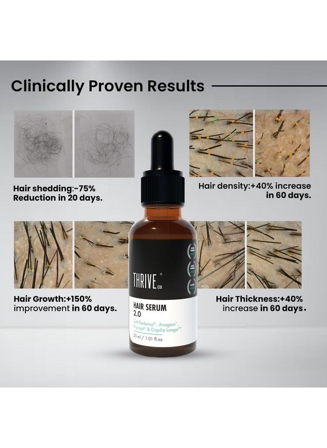 Restorative Hair Growth Duo | Hair Growth Serum 2.0 (50Ml) + Hair Vitalizing Rosemary Shampoo (250Ml) | With Caffeine, Black Castor Oil, Capila Longa Biotin | For Men And Women