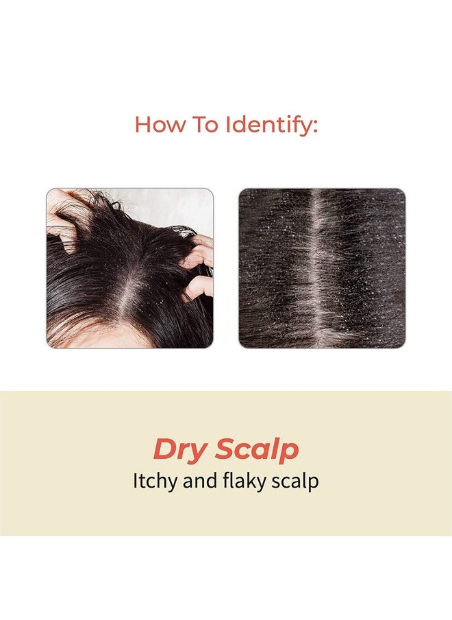 Customised Ayurvedic Hair Fall Oil | Vedix Shvedan Hair Fall Oil | For Dry Scalp | With Castor + Sesame + Olive | For Reducing Hair Fall | For Hair Growth | -100Ml