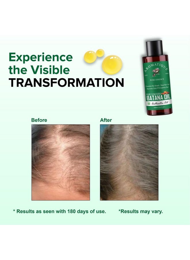 Batana Oil - Pure Batana Oil For Hair Growth By Dr Sebi Sourced From Honduras, Batana Oil Cold Pressed, Derived From Palm Nut Oil For Hair & Skin (100 Ml)