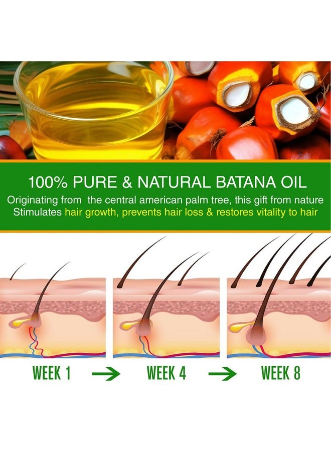 Batana Oil For Hair Growth - Batana Oil Cold Pressed Derived From Palm Nut - Helps Hair Grow Stronger -Hair And Skin Care Oil (Pack Of 1, 30 Ml)