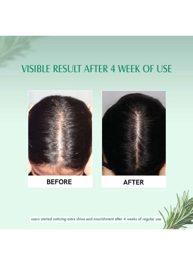 Rosemary Oil And Hair Growth Serum Combo