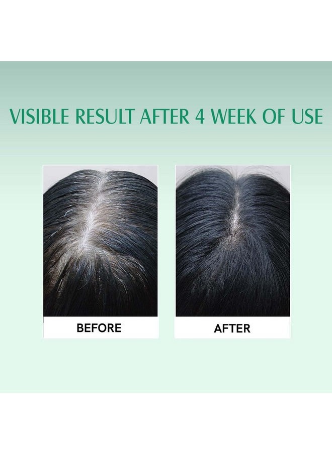 Rosemary Lavender Hair Oil For Healthy Hair, Scalp, Hair Roots - 100% Pure & Natural - For Hair Growth & Hair Fall Control - 200 Ml