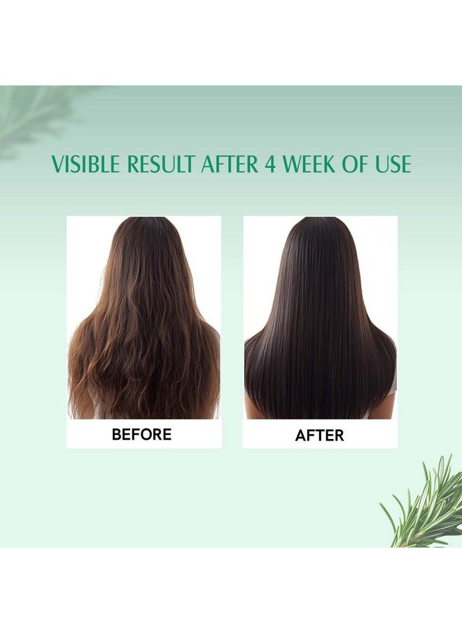Rosemary & Biotin Hair Growth Serum - For Hair Growth, Strengthens Hair, And Nourishes Scalp - 30 Ml
