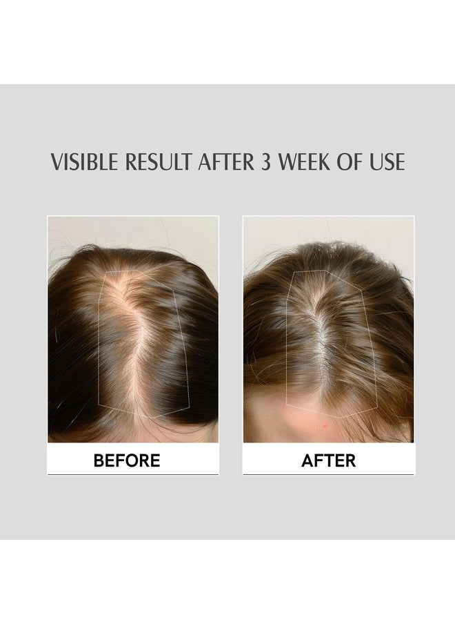 Hair Growth Serum With 3% Redensyl, 2% Anagain, 2% Procapil - For Hair Growth And Hair Fall Control - For Men & Women - 30 Ml