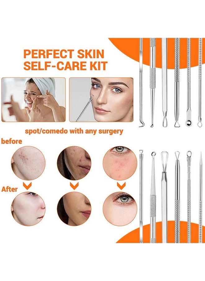 ® 9Pcs Blackhead Remover Tools Stainless Steel Blackhead Pimple Blemish Extractor/Remover Tool With Tweezers, Professional Acne Remove Tools