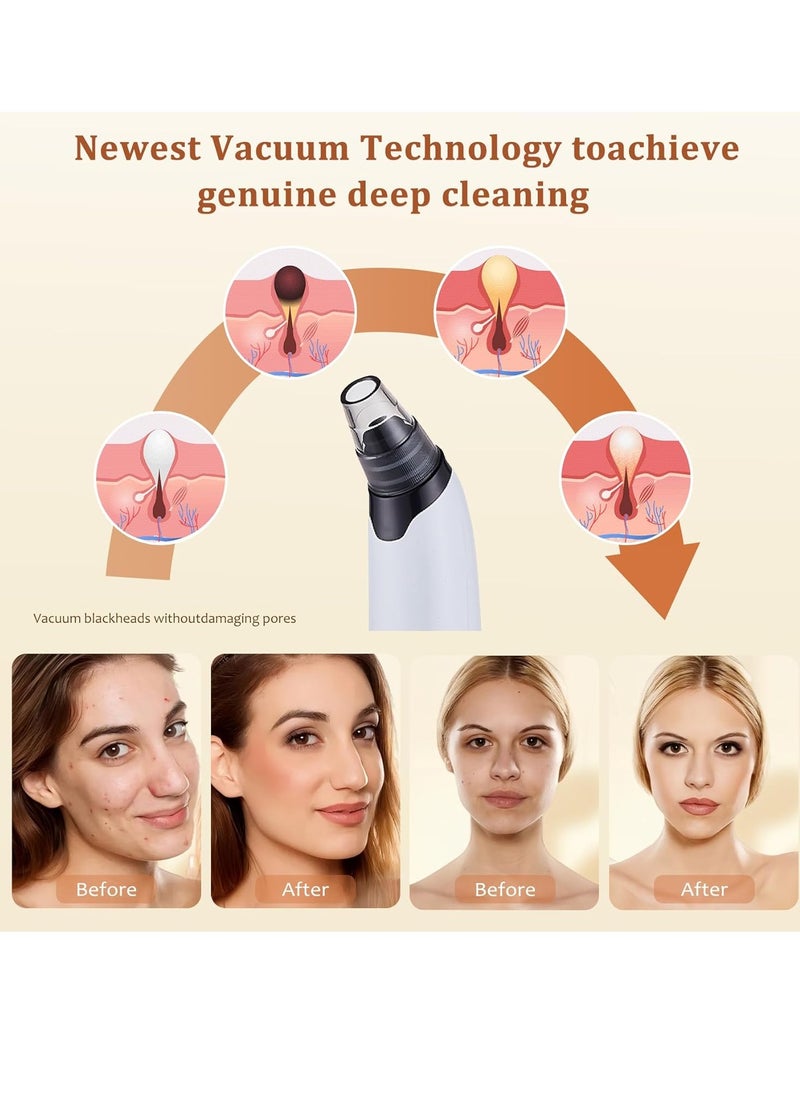 Blackhead Remover Vacuum - Powerful Pore Vacuum for Cleansing, Blackhead Extractor with 3 Adjustable Suction Levels, 4 Blackhead Removal Tools, USB Rechargeable，Suitable for Women and Men