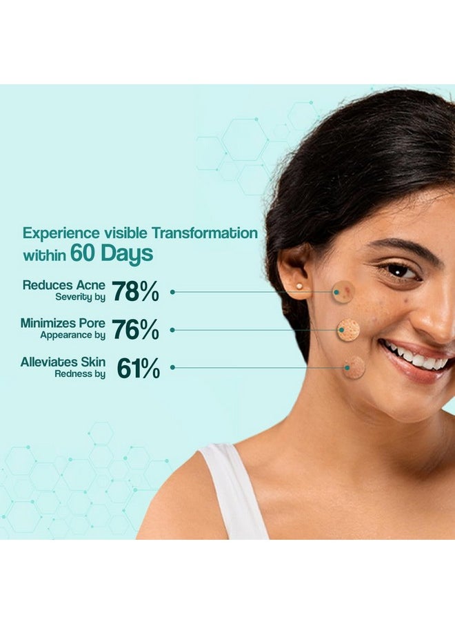 Dr. Reddy'S Acne Control Moisturizer I For Oily & Acne Prone Skin I Prevents Acne Breakouts|Oil Free, Non Sticky I 75G