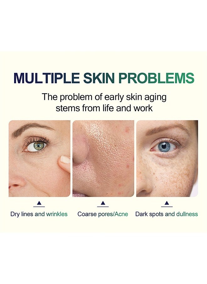 45% TCA Acid Skin Peel -  Malic Acid & Citric Acid, Anti-Aging, Reduce Acne and Dark Spots, Even Skin Tone, TCA 45% Skin Peel, 45% TCA Chemical Peeling Serum with Malic and Citric Acid for Dark Skin, Dark Spots and Acne Spots, Natural Skin Care - 30 ml/1 fl oz