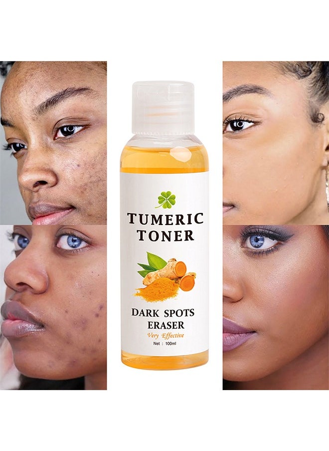 Tumeric Toner Dark Spots Eraser -  Facial Toner for Acne Prone Skin, Blemish Removing Facial Moisturizer for Women, Dry Oily Skin Hyperpigmentation Treatment 100ml