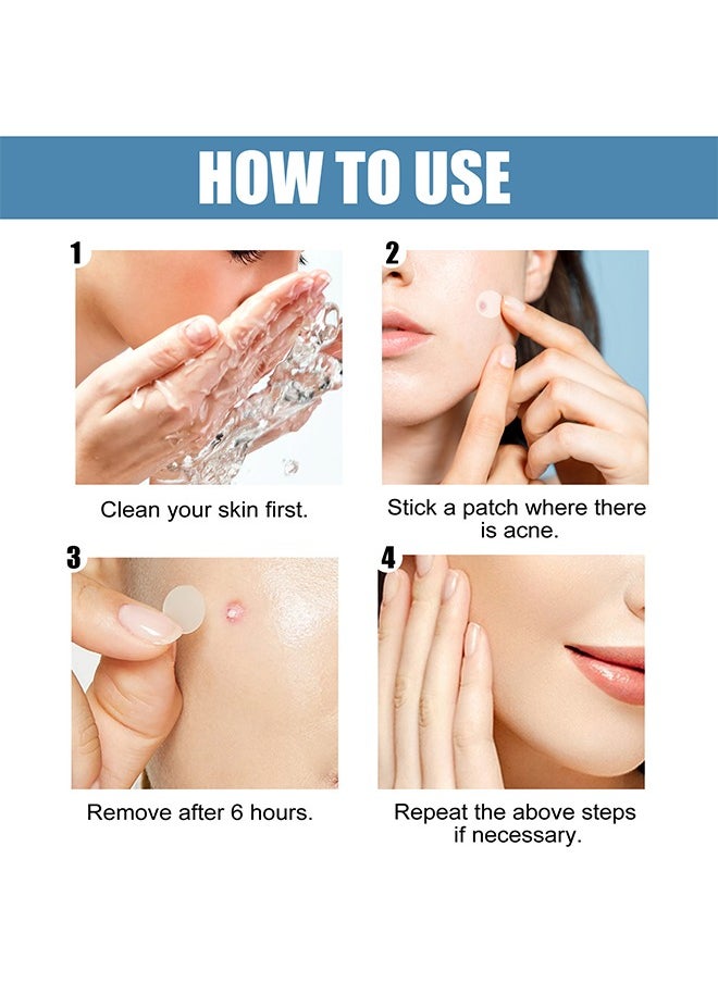 Acne Patch - 5 Sizes Of Patch Healing Acne And Pustule Can Be Used Day And Night , Acne patch can be made up IOnvisible Acne-Clearing Anti-acne-Closing Acne Waterproof Concealer Hydrocolloidal Acne Patch 80 Patches