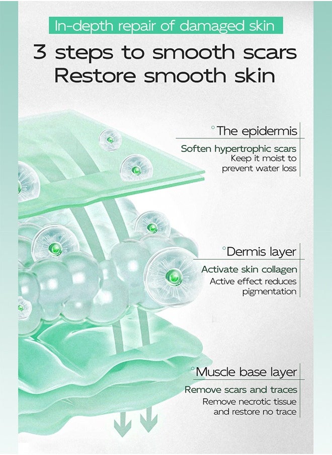 15g Acne Scar Removal Cream for Skin, Scar Treatment Relief Cream, for Surgical Scar on Face Treats Remover Old and New Scars Reduces the Appearance of Scars from