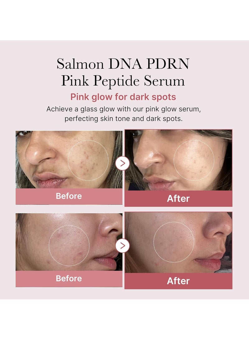 Rose PDRN Pink Peptide Serum 30ml