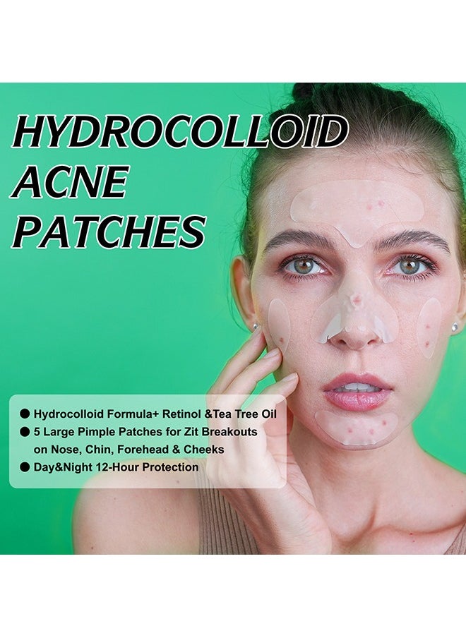 10 Facial Acne Patches - Hydrocolloid Acne Patches to Cover Pimples and Blemishes - Acne Patches for Skin Care