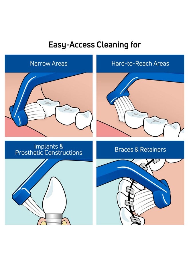 TEPE Angled Soft Bristle Toothbrush, Orthodontic Toothbrush for Braces, Small Head Toothbrush for Retainers, Implants, Universal Care, 1 Pk