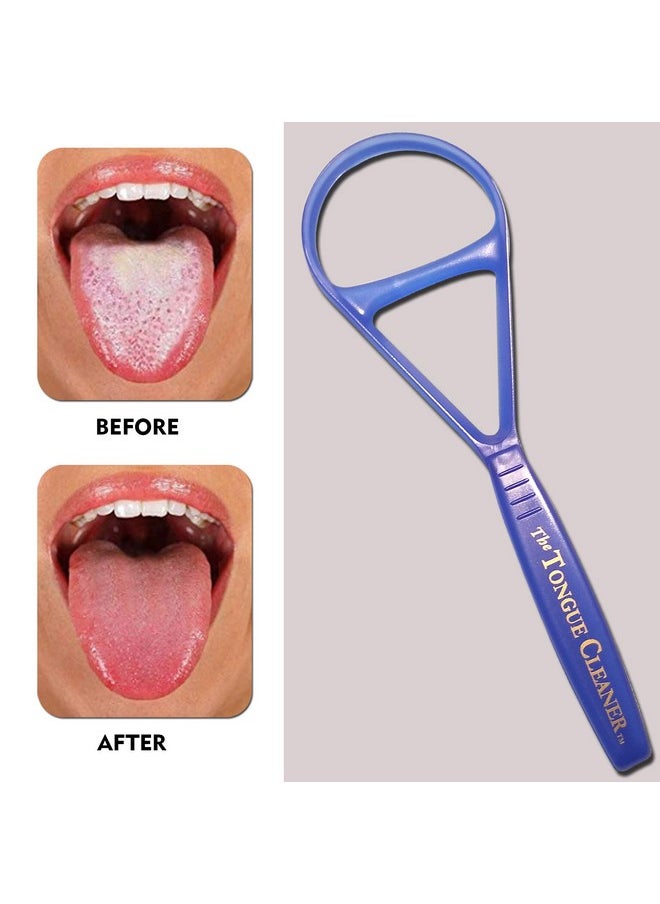 Tongue Scraper Cleaner - the Tongue Cleaner - End Bad Breath and Freshens Breath - Eliminate Bad Breath - Bad Breath Treatment (Color May Vary)