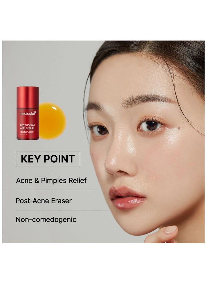 Red Succinic Acid Acne Serum for Acne Treatment & Pigmentation Brightening - Powerful Blend of Salicylic Acid & Niacinamide - 30ml