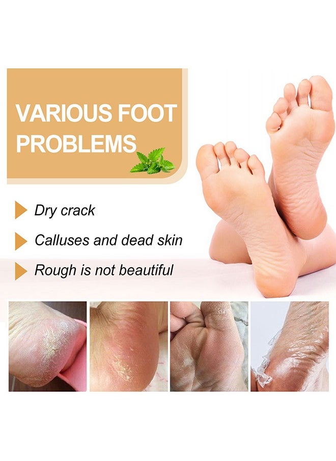 Foot Callus Removal Spray ，Cleans Dead Skin Cuticles Calluses Prevents Dryness Repairs Rough Skin and Moisturizes Care Spray