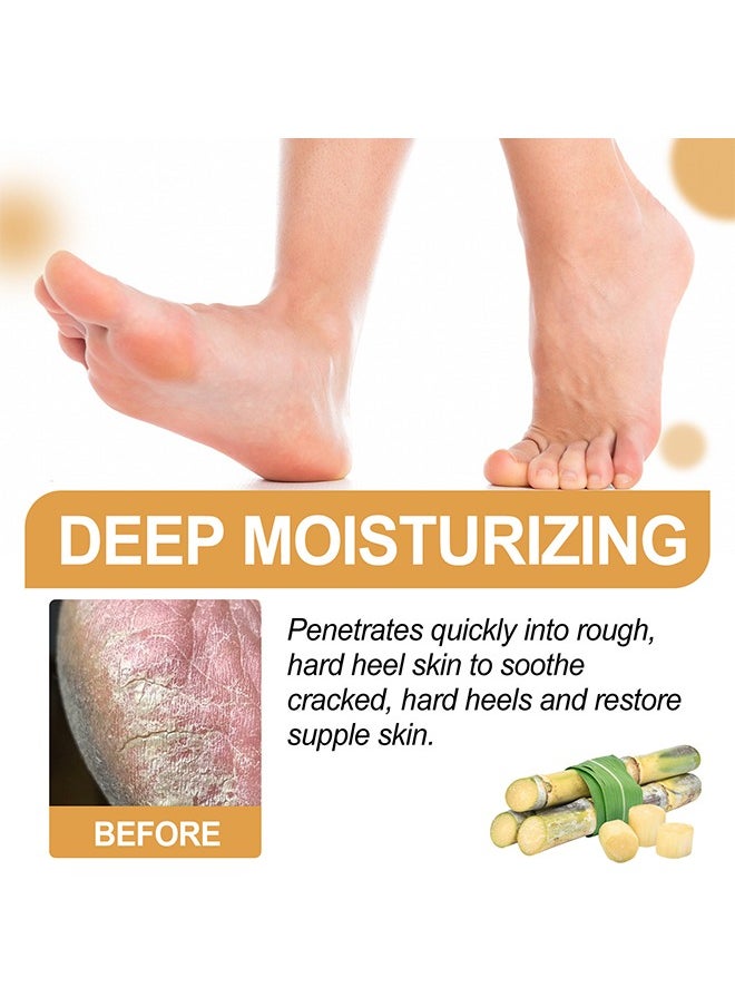 Foot Callus Removal Spray ，Cleans Dead Skin Cuticles Calluses Prevents Dryness Repairs Rough Skin and Moisturizes Care Spray