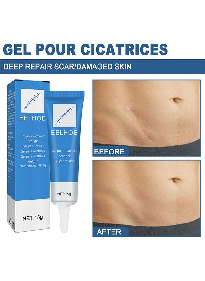 Scar gel - Helps Soften And Smooth Raised Scars, Maintaining The Moisture Balance of The Adjacent Skin, Reduces Discolouration, Redness, Pain and Discomfort of Scars 15g