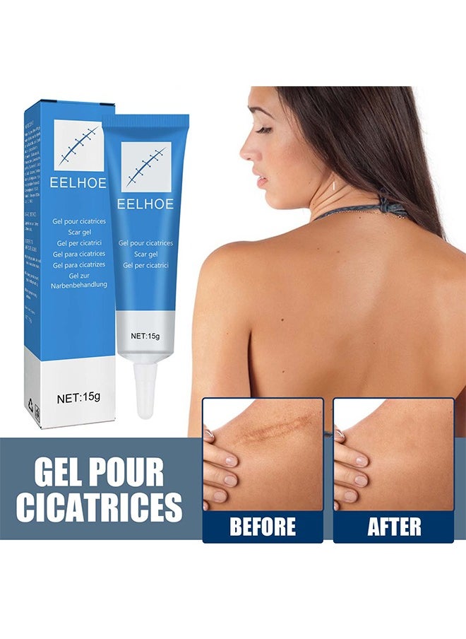 Scar gel - Helps Soften And Smooth Raised Scars, Maintaining The Moisture Balance of The Adjacent Skin, Reduces Discolouration, Redness, Pain and Discomfort of Scars 15g