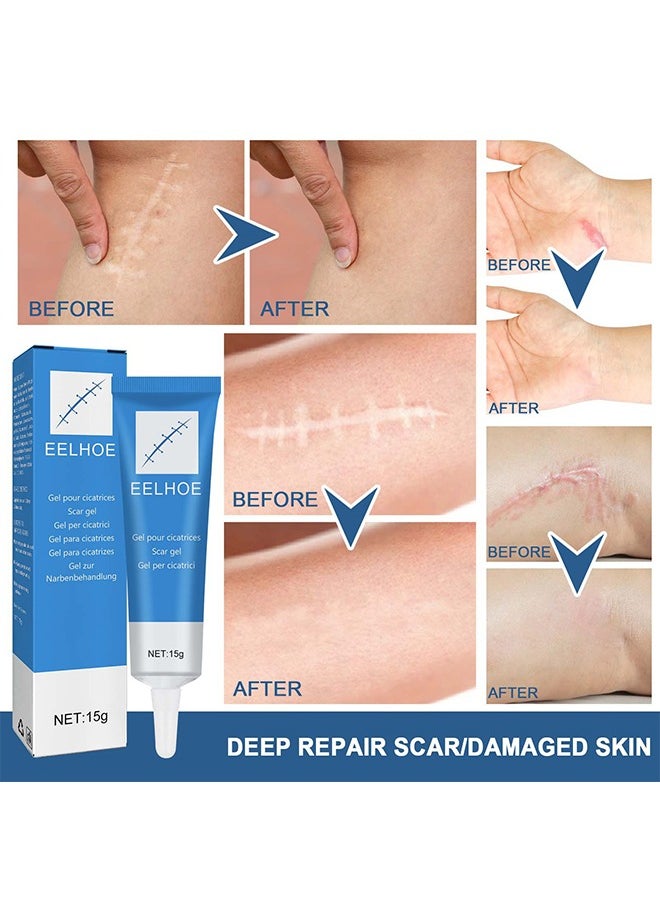 Scar gel - Helps Soften And Smooth Raised Scars, Maintaining The Moisture Balance of The Adjacent Skin, Reduces Discolouration, Redness, Pain and Discomfort of Scars 15g