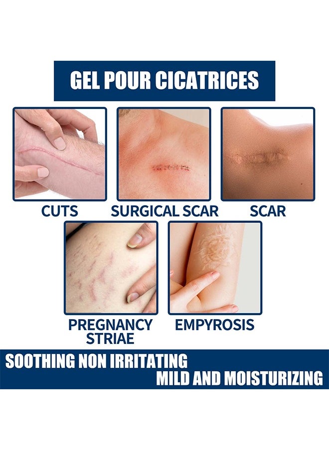 Scar gel - Helps Soften And Smooth Raised Scars, Maintaining The Moisture Balance of The Adjacent Skin, Reduces Discolouration, Redness, Pain and Discomfort of Scars 15g