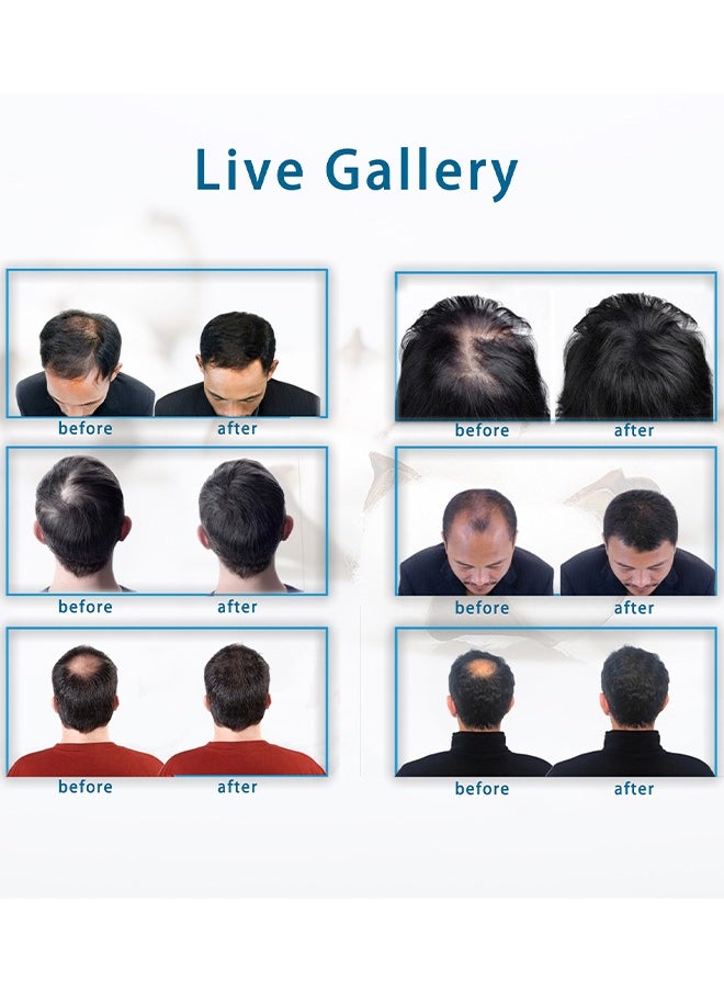 Hair Building Fibers, Fill In Fine or Thinning Hair Instantly Thicker, Fuller Looking Hair for Men and Women Dark Brown 22g