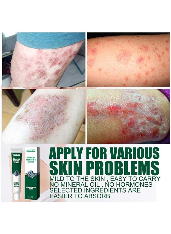 Advanced Psoriasis&Eczema Natural Herbal Cream，Organic Eczema Herbal Healing Cream, Chinese Herbal Eczema, Natural Herbal Cream, Psoriasis Ointment Cream, Moisturising Cream, Face Cream, Body Cream for Dry Skin, Itch Skin, Itch Relief Cream 20G