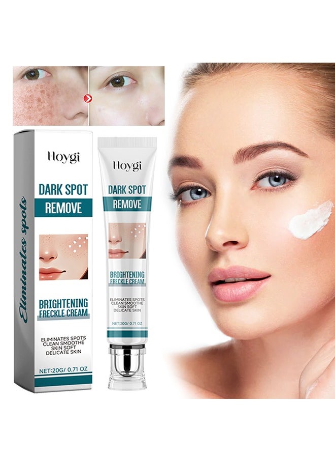 Dark Spot Remove,Brightening Freckle Cream,Ultimate Brightening & Freckle Removal Cream - Powerful Whitening Cream for Age Spots, Dark Spots, and Skin Pigmentation | Fade Freckles, Chloasma, and Sun Spots for Even Skin Tone-20g