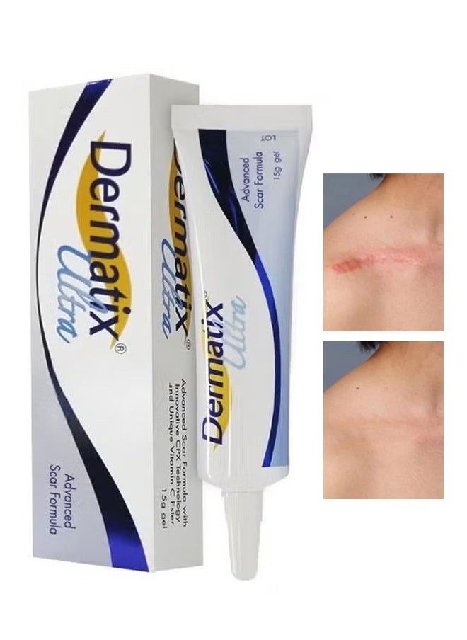 Advanced Scar Formula, Scar Repair, Hypertrophic Scars Gel 15G
