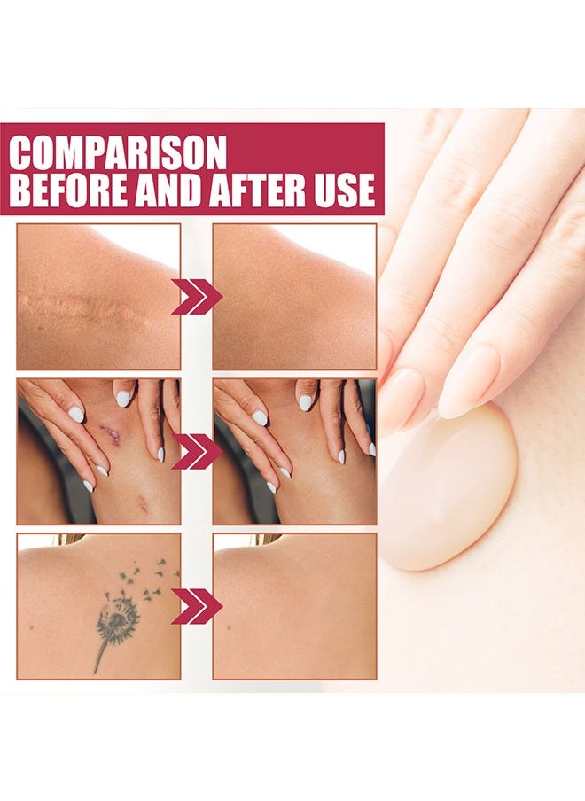 Body Makeup Foundation-Coverage Perfector Tatoo Concealer Waterproof Covering Body Tattoo Scars 100ml