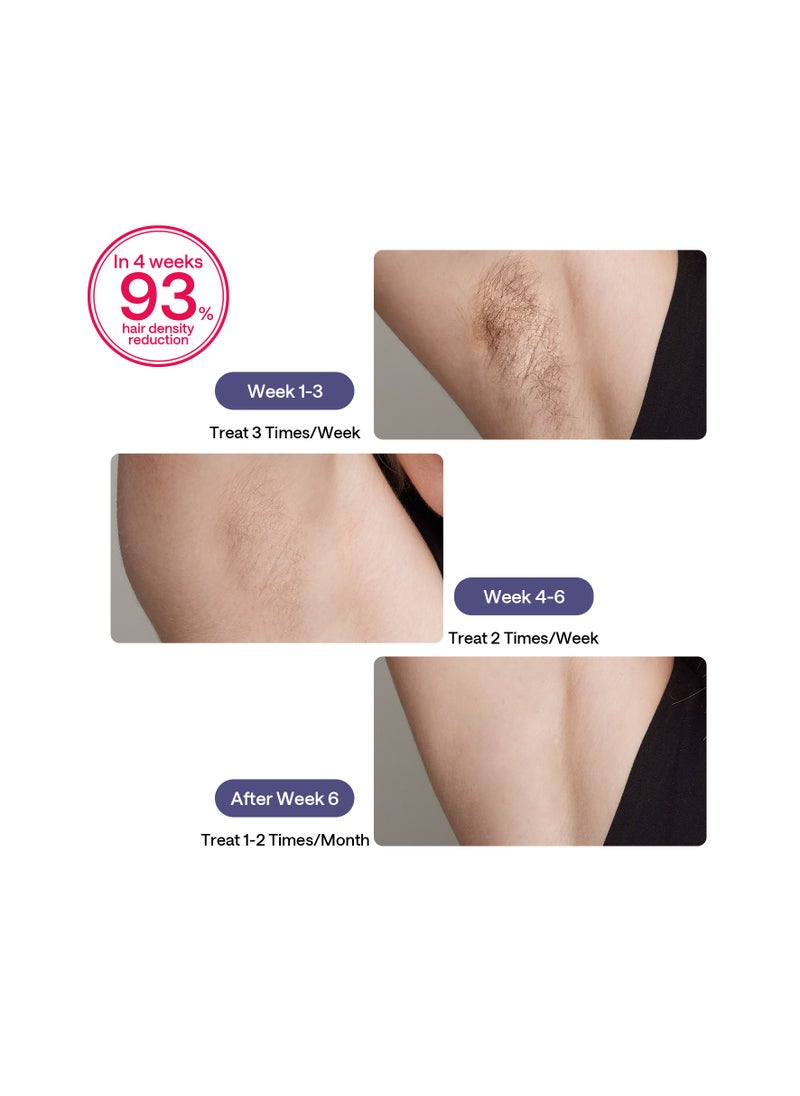 Ulike Laser Hair Removal for Women and Men, Air 3 Ice-Cooling IPL Device Hair Removal for Nearly Painless & Long-Lasting Results, 3 Modes & Auto Flashing for Fast Full Body Hair Removal from Home