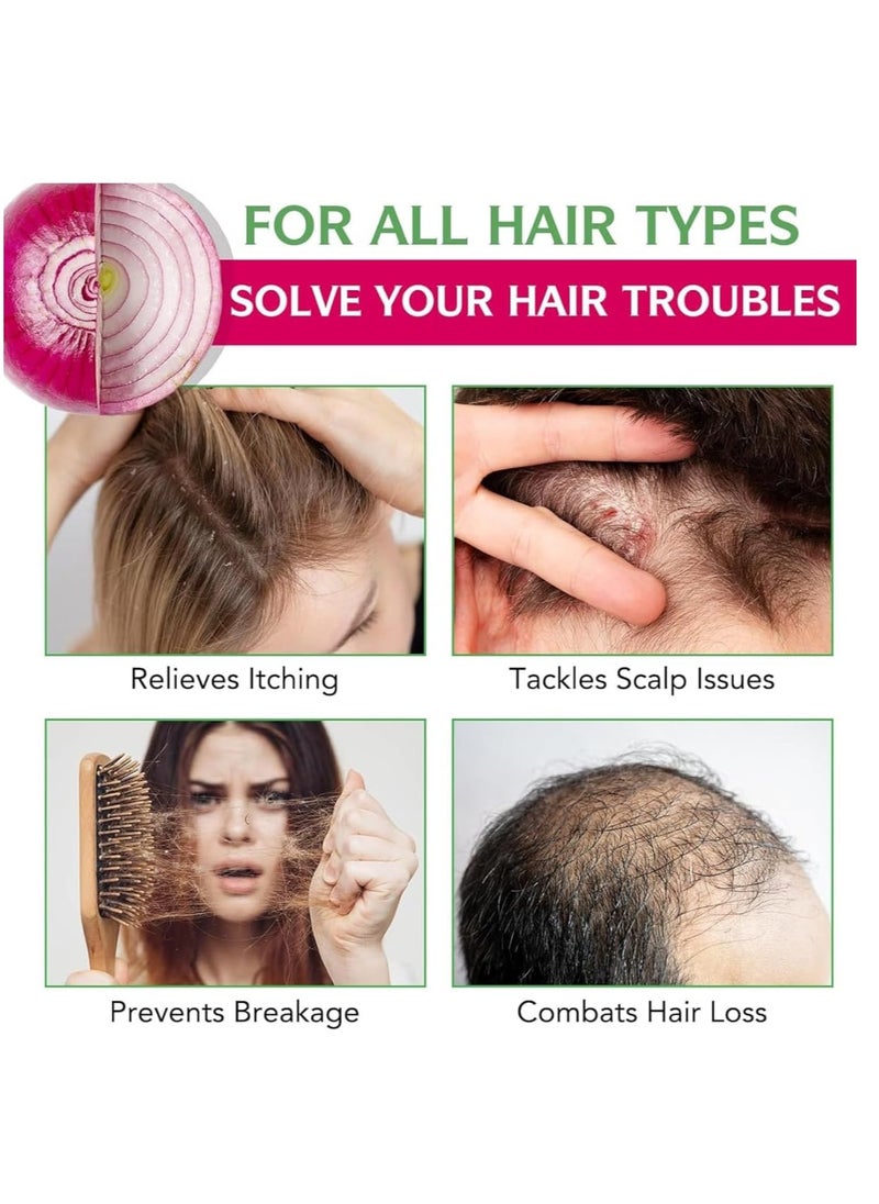 Biotin & Rosemary Shampoo with Onion for Hair Growth - Strengthens, Thickens & Nourishes - Anti-Hair Loss, Paraben-Free, Silicone-Free Formula 250-250 ML