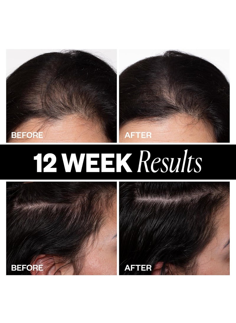 IGK Sponsored Hair Density Scalp Treatment 63 ml / 2.1 oz