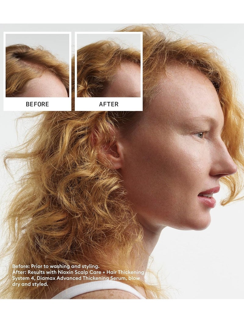 Nioxin System 4 Scalp + Hair Thickening Shampoo For Colored, Dry, & Damaged Hair with Progressed Thinning Maintain Vibrant Color Nourish & Boost Hair Density with Niacinamide & Biotin