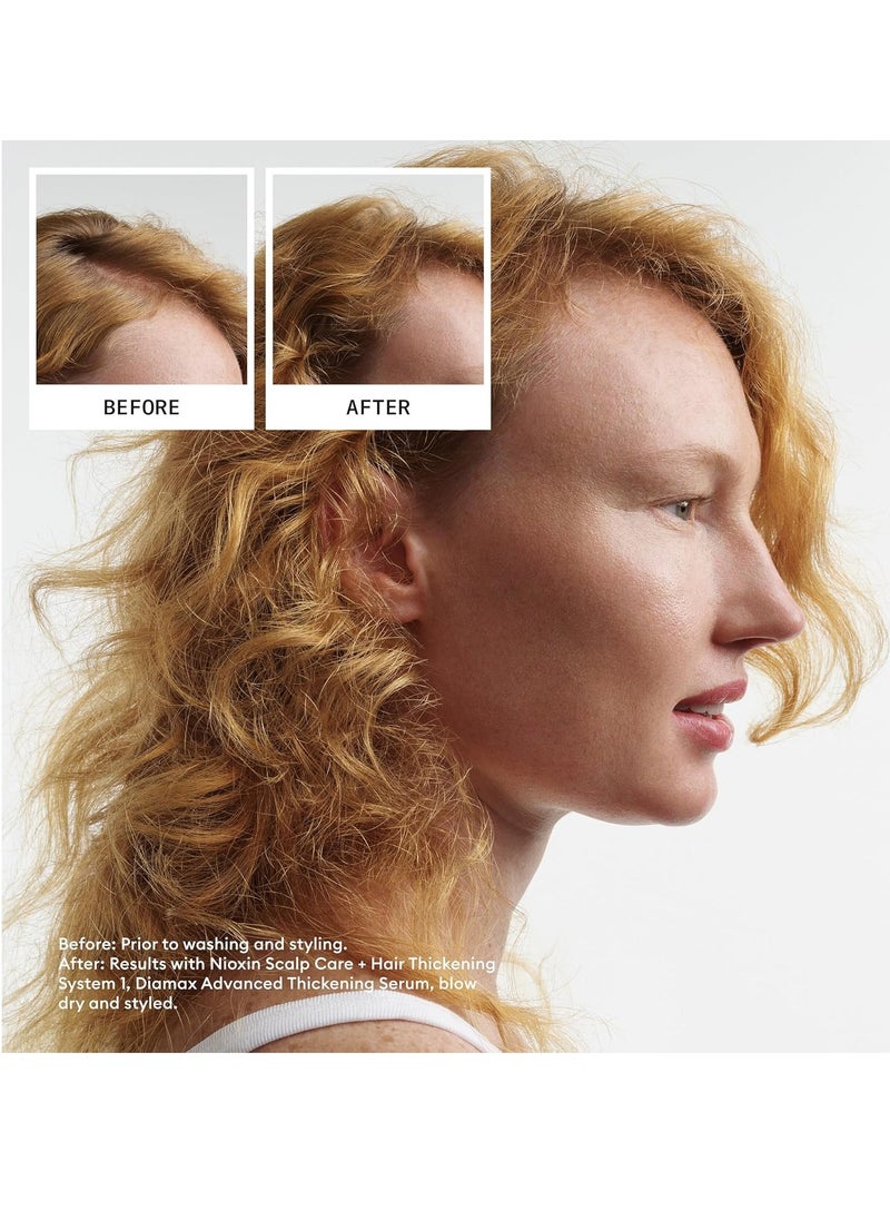 Nioxin System 1 Scalp + Hair Thickening Shampoo | For Natural Hair with Light Thinning | Strengthen Against Breakage with Niacinamide & Biotin