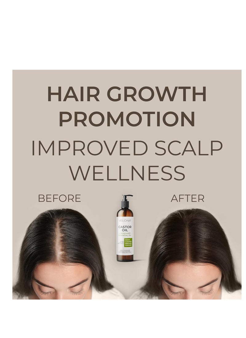 velona Castor Oil with Rosemary Oil - 8 oz | Hair Growth Oil | Hair, Scalp, Eyelashes, Eyebrows | 100% Natural and Pure