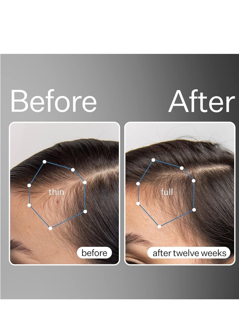 ACT+ ACRE Cold Processed Stem Cell Scalp Serum - Promotes Thicker and Fuller-Looking Hair - Soothes and Hydrates the Scalp - Sulphate and Paraben Free - Aloe Vera for Improved Scalp Health - 1 fl oz.