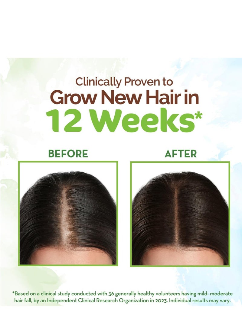 Mamaearth Rosemary Hair Growth Oil | Control Hair Fall & Strengthens Weak Follicles | Scalp Care with Methi Dana for Strong Roots | 5.07 Fl Oz (150ml)
