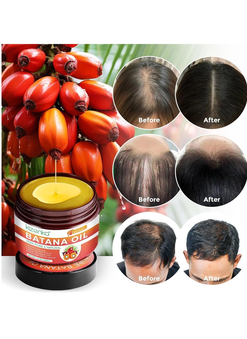 100% Natural Raw Batana Oil for Hair Growth,Organic Pure Batana Oil Prevent Hair Loss, Batana Oil Hair Growth, Batana Hair Oil Sourced from Honduras, Eliminates Split Ends-4.2 oz