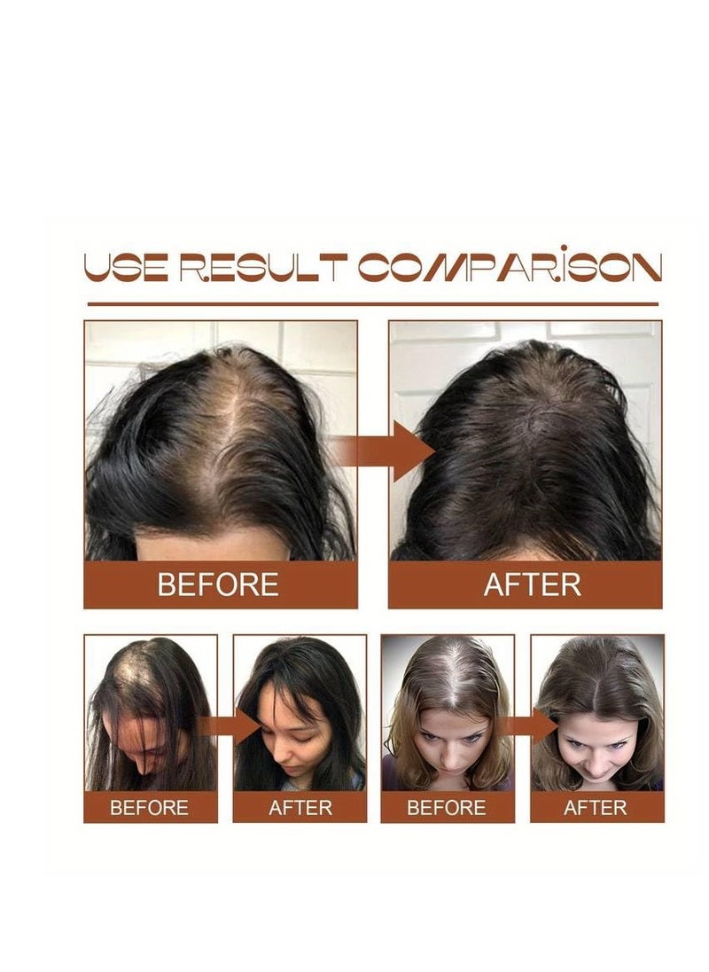 Organic Batana Oil for Hair Growth, Nourishment and Breakage Control - 4.05 Fluid Ounces